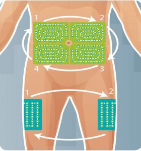 sites injections insuline