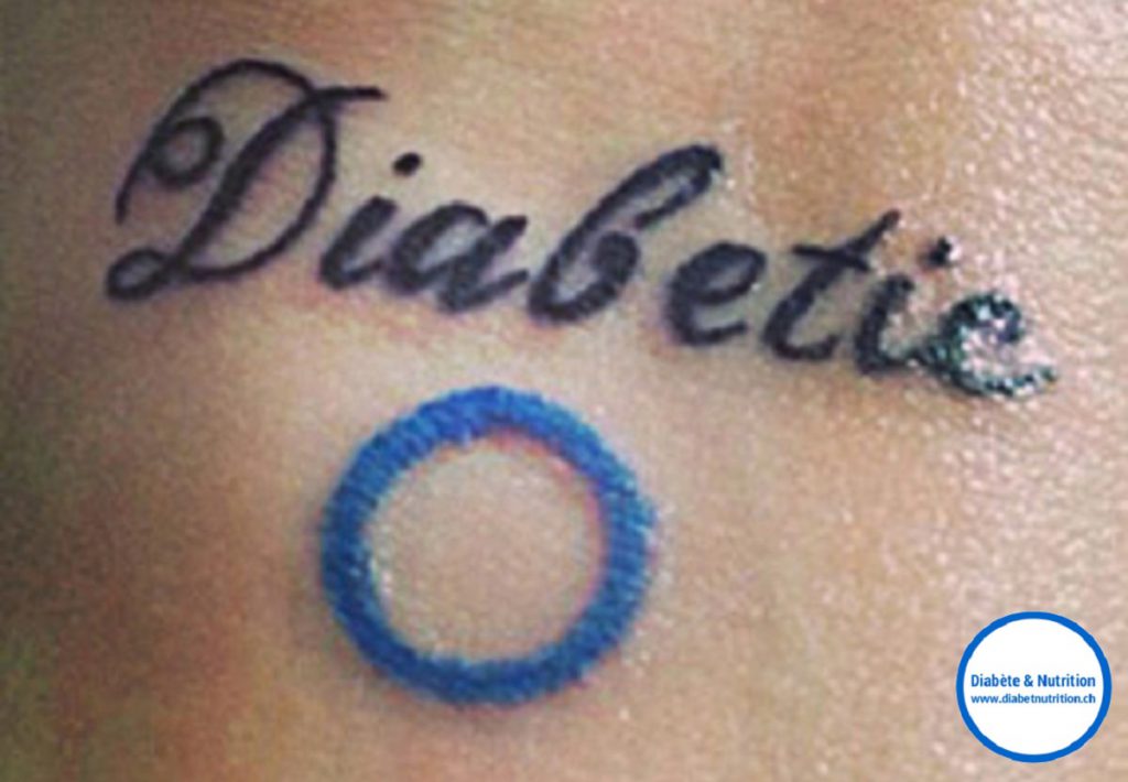 diabète, tatouages, tatoueur, encre, derme, chéloïde